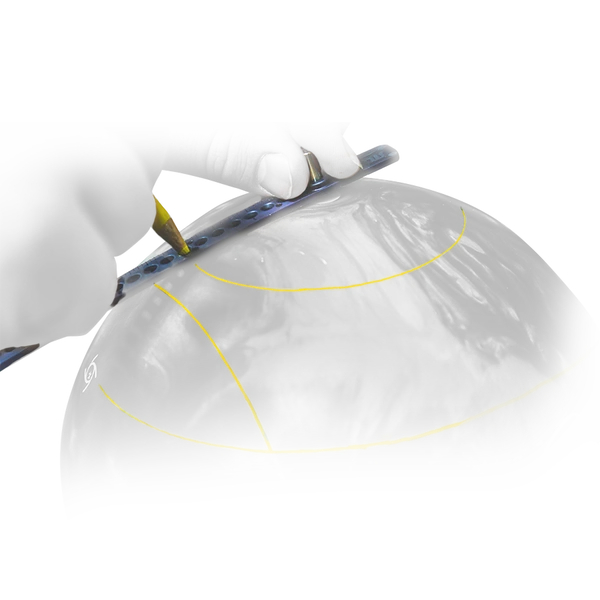Storm Arc Ruler 3 Storm Arc Ruler